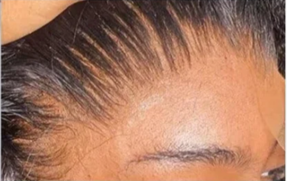 Glueless Curly 13x6 HD Lace Wig (Human Blend)